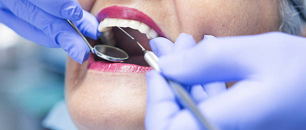Best Emergency Dental Filling Replacement  in Goshen, IN